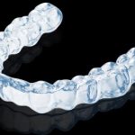 <h1>Clearing Smile Roadblocks: A User-Centered Guide to Choosing Invisible Braces</h1>